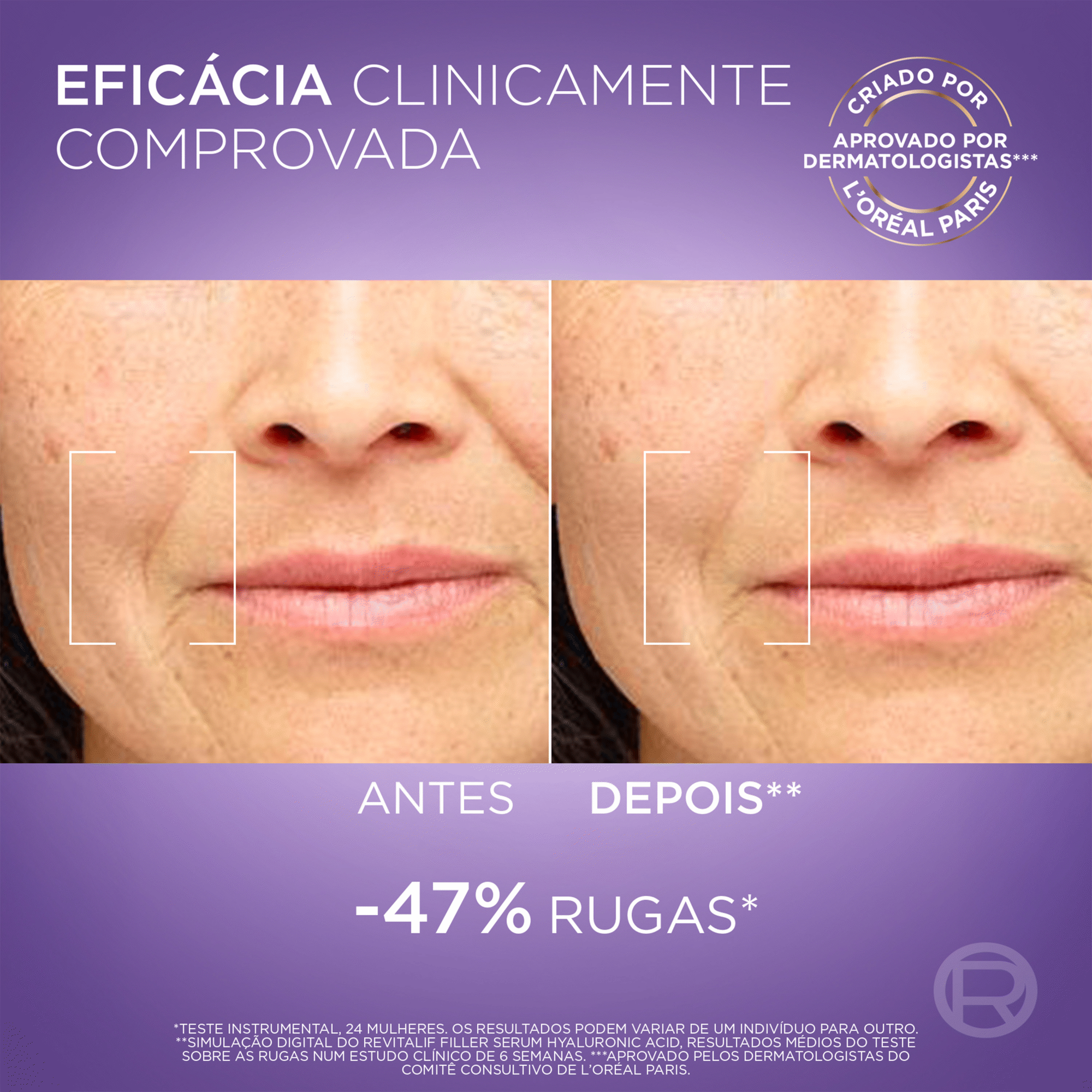 S&eacute;rum Facial Revitalift Filler Antirrugas L'Or&eacute;al Paris