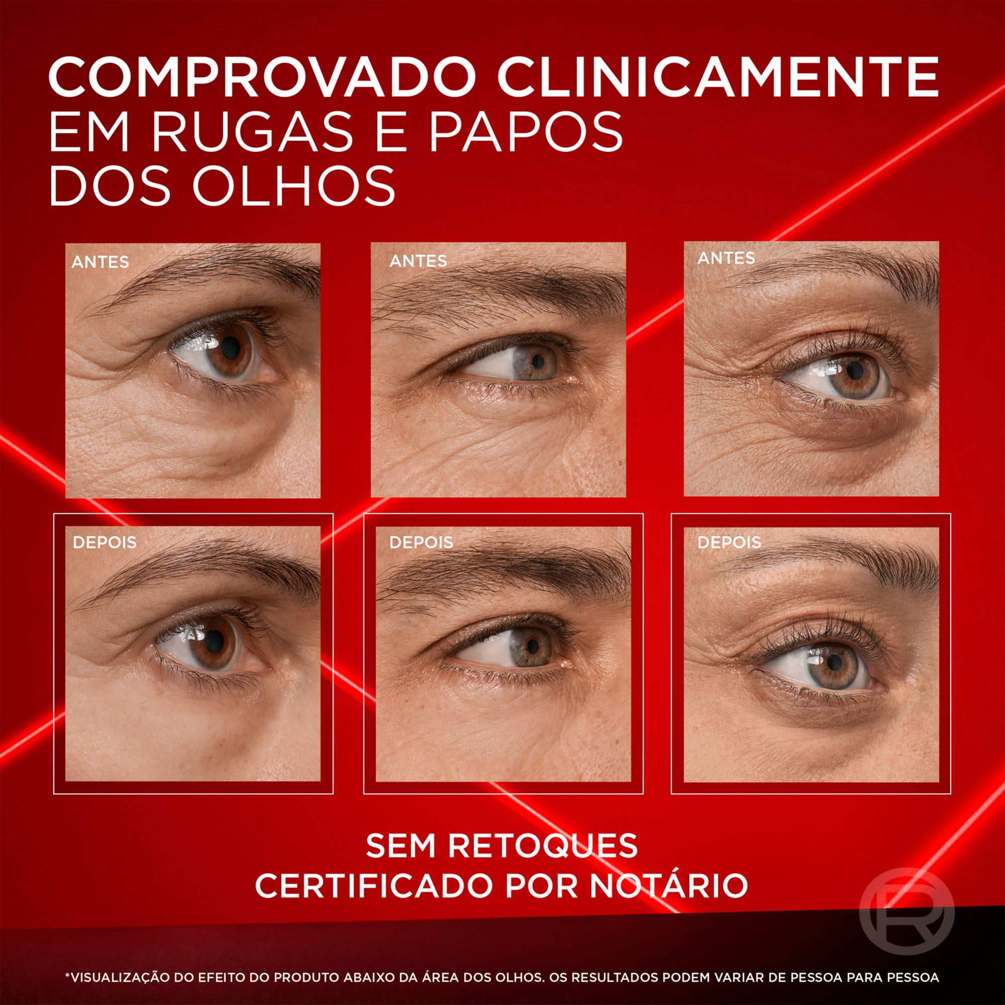 Creme de Olhos Revitalift Laser L'Or&eacute;al Paris