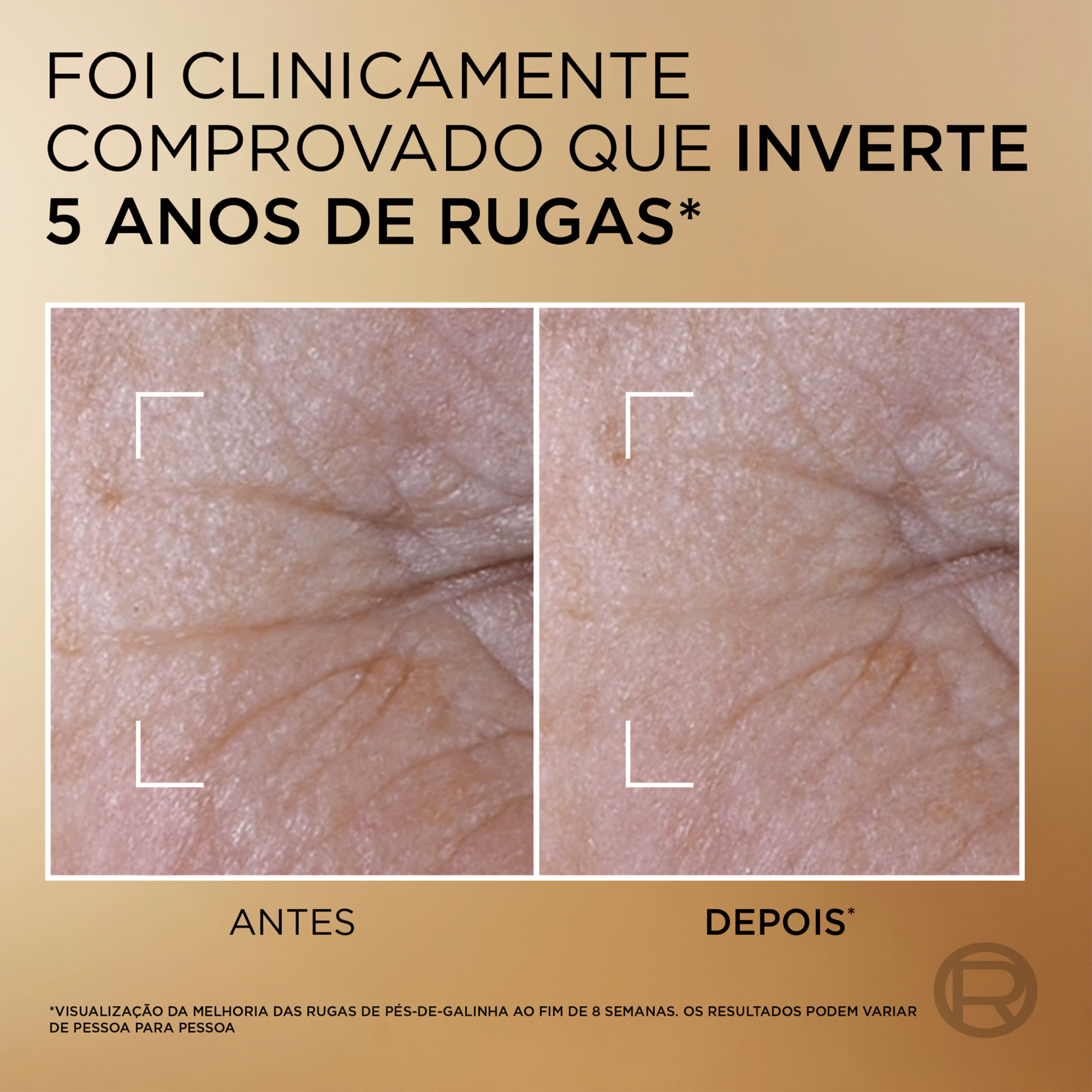 S&eacute;rum Facial Age Perfect Le Duo Rejuvenescedor L'Or&eacute;al Paris