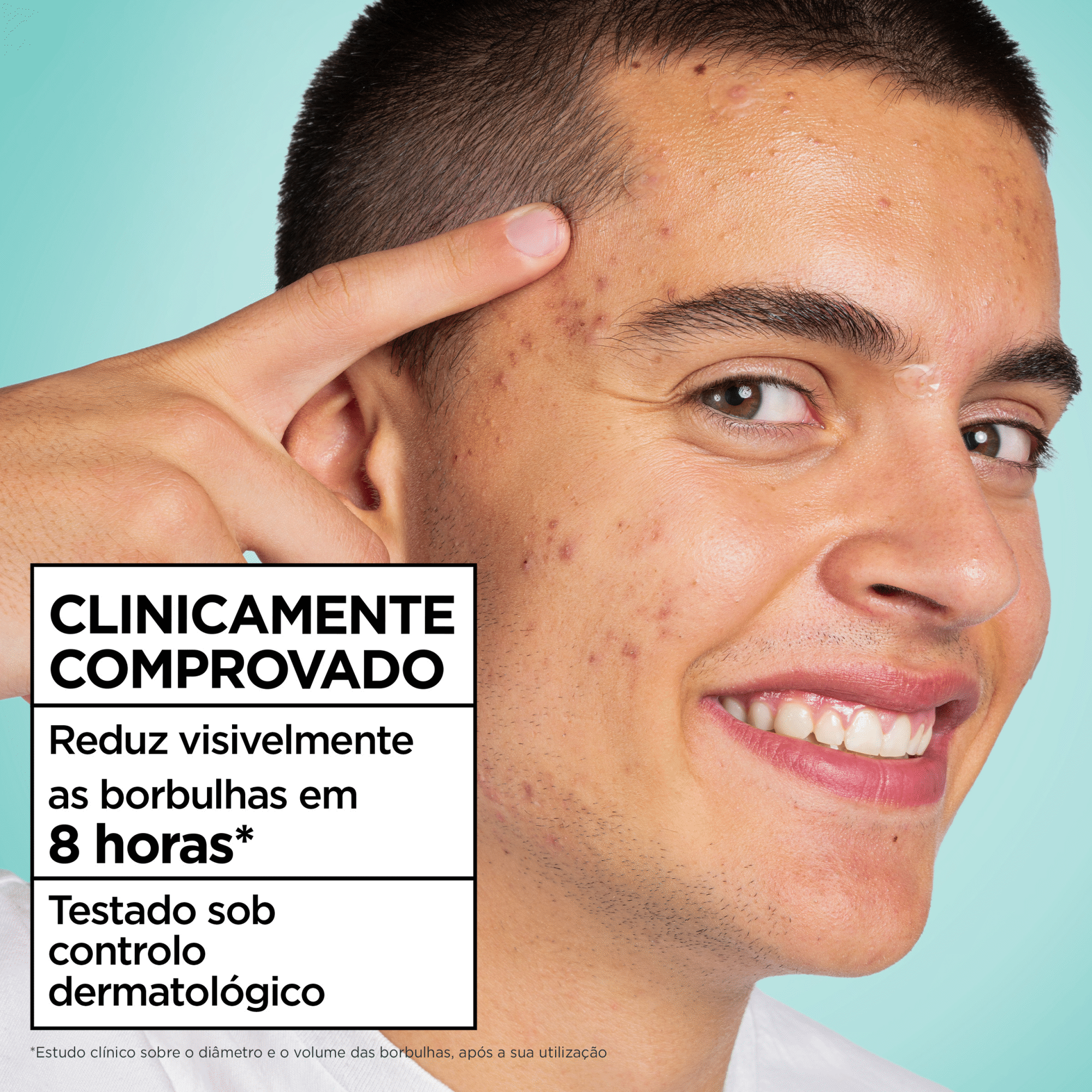 Adesivos Faciais Borbulhas Garnier Skin Active