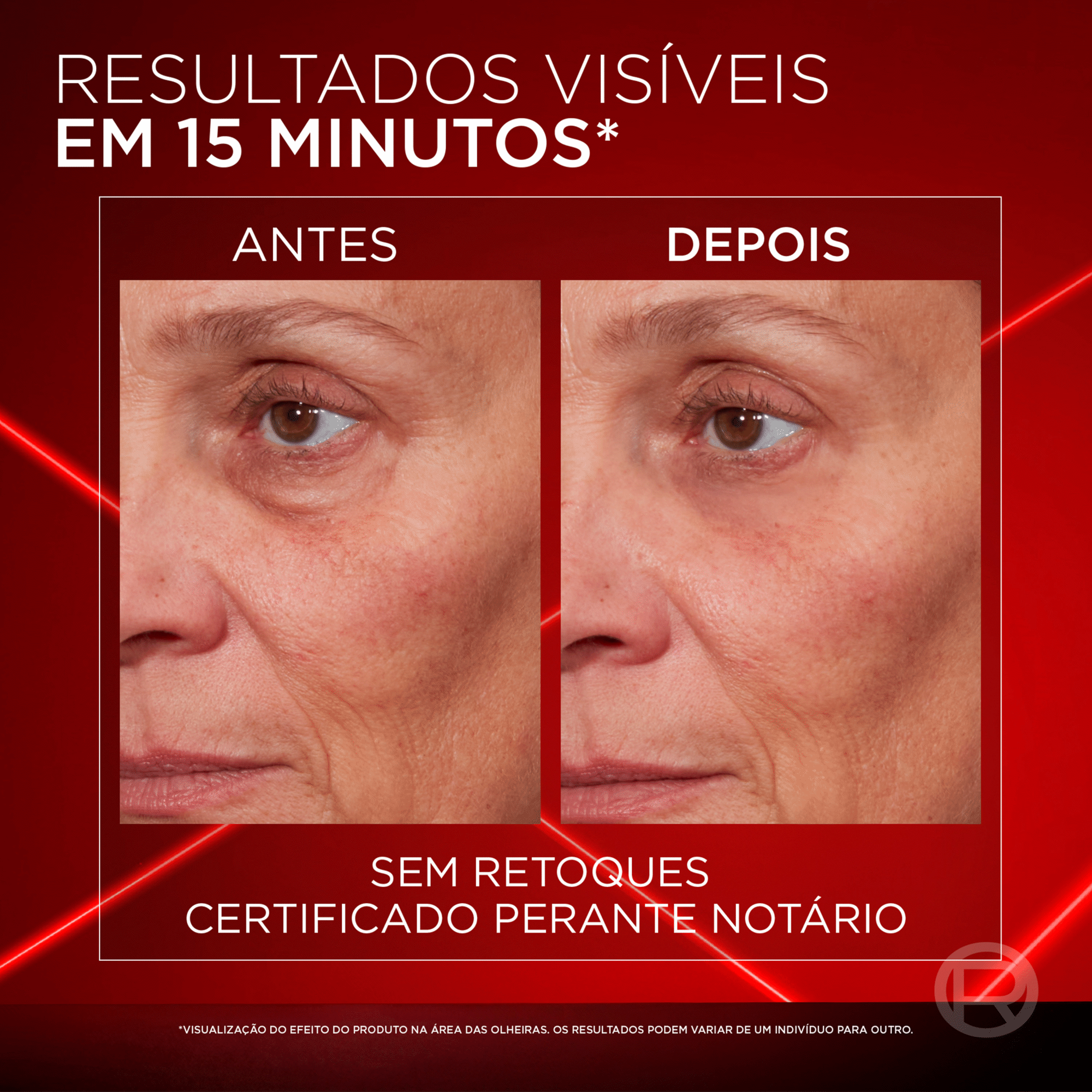 Creme de Olhos Revitalift Laser L'Or&eacute;al Paris