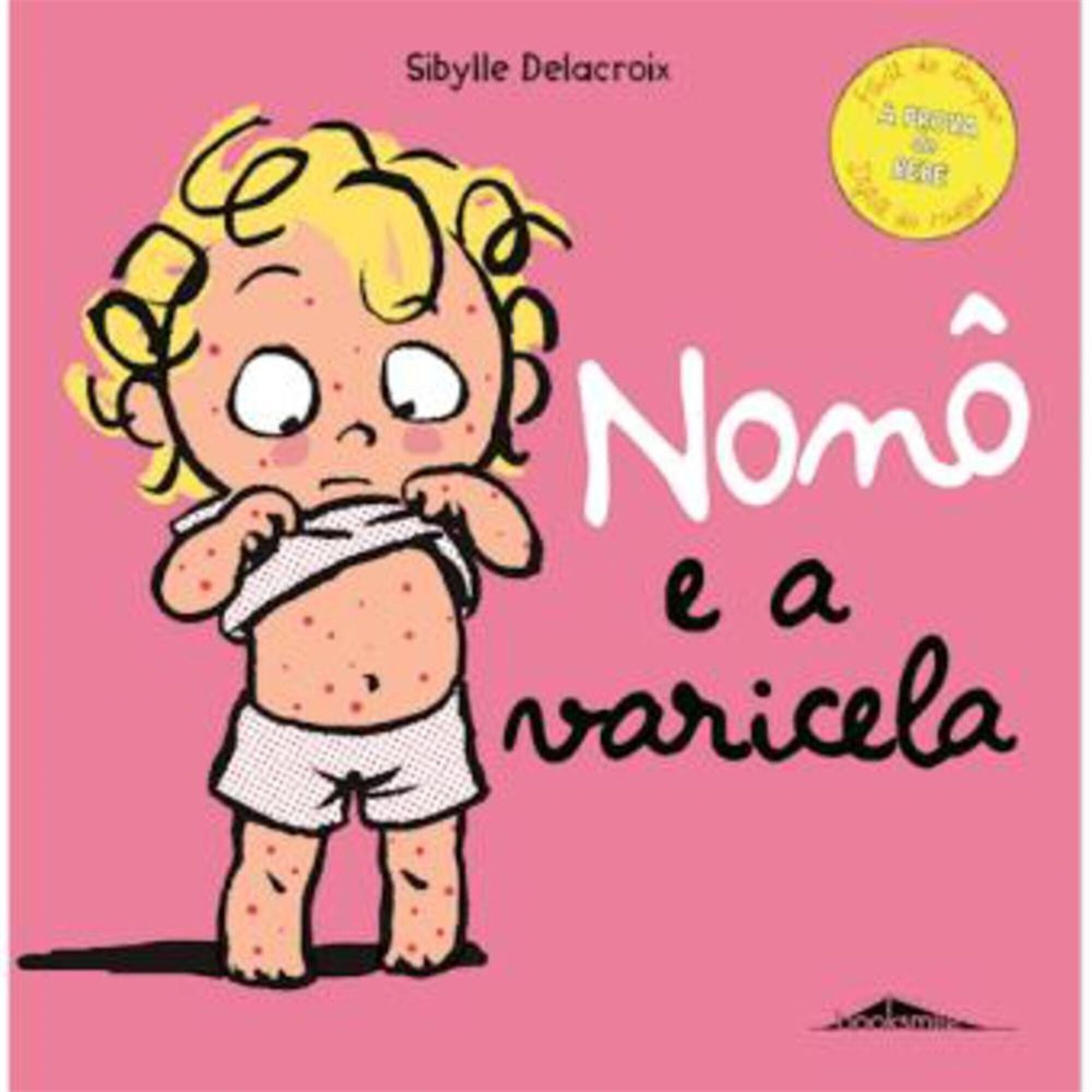 Non&ocirc; e a Varicela de Sibylle Delacroix