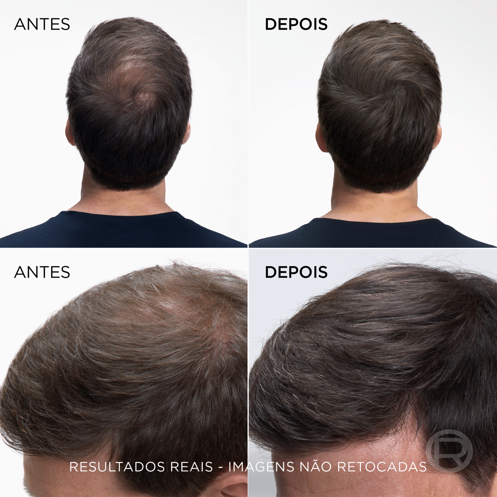 Colora&ccedil;&atilde;o Retoca Ra&iacute;zes Spray Moreno 2 L'Or&eacute;al Paris Magic Retouch