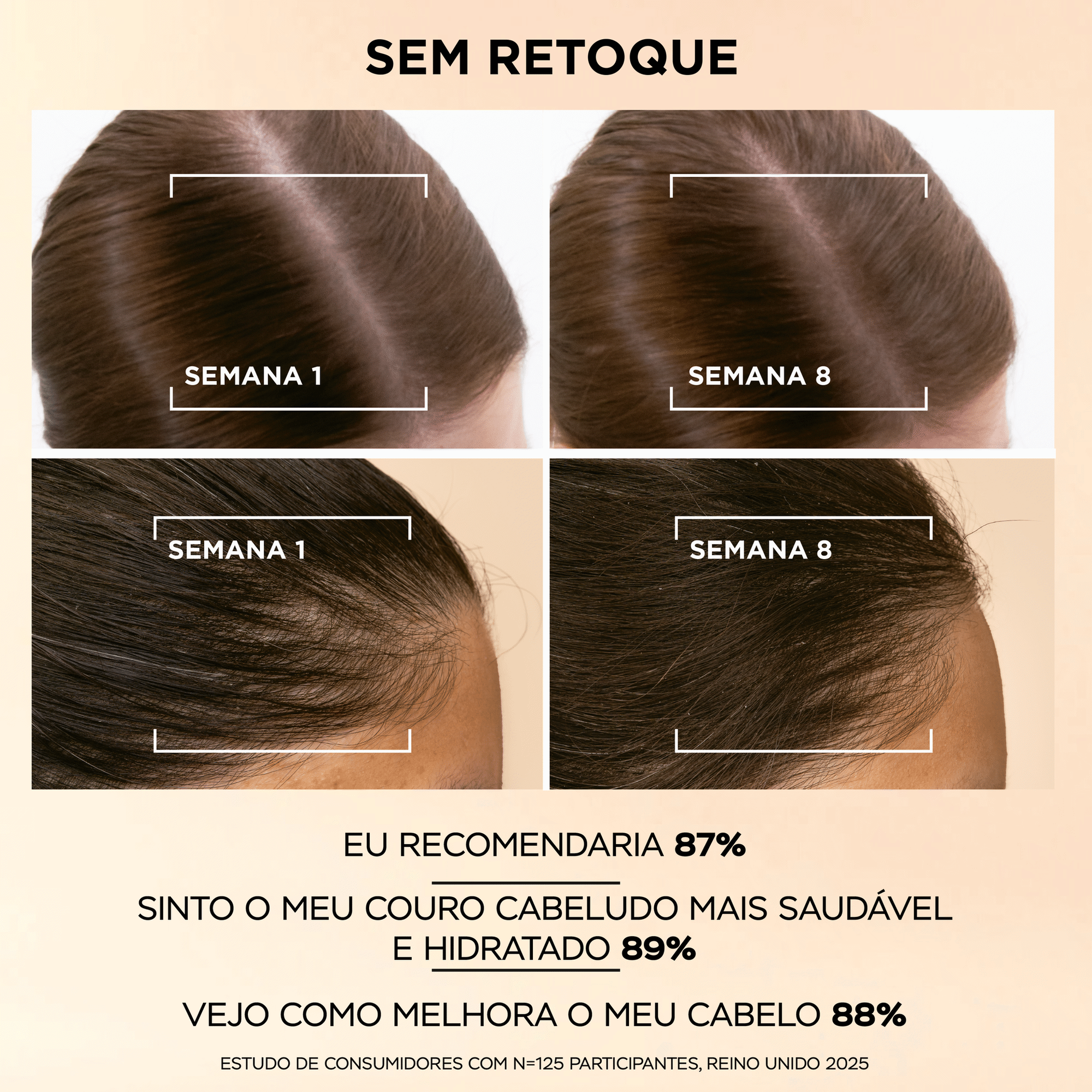 S&eacute;rum de Cabelo Anti-Queda Pantene&nbsp;