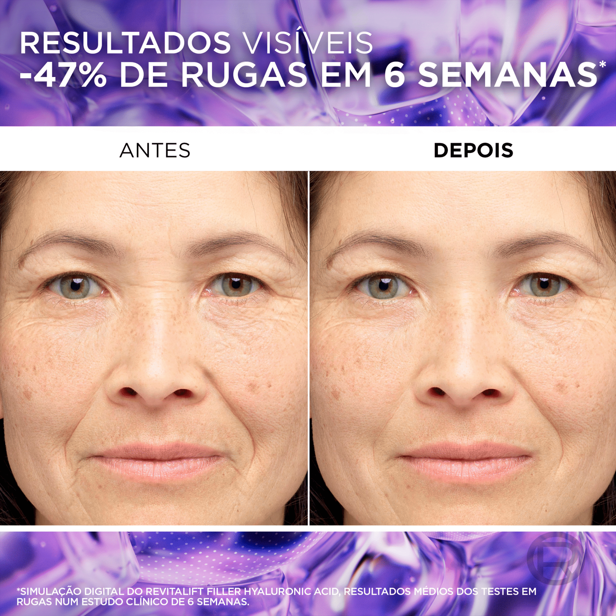 S&eacute;rum Facial Revitalift Filler Antirrugas L'Or&eacute;al Paris