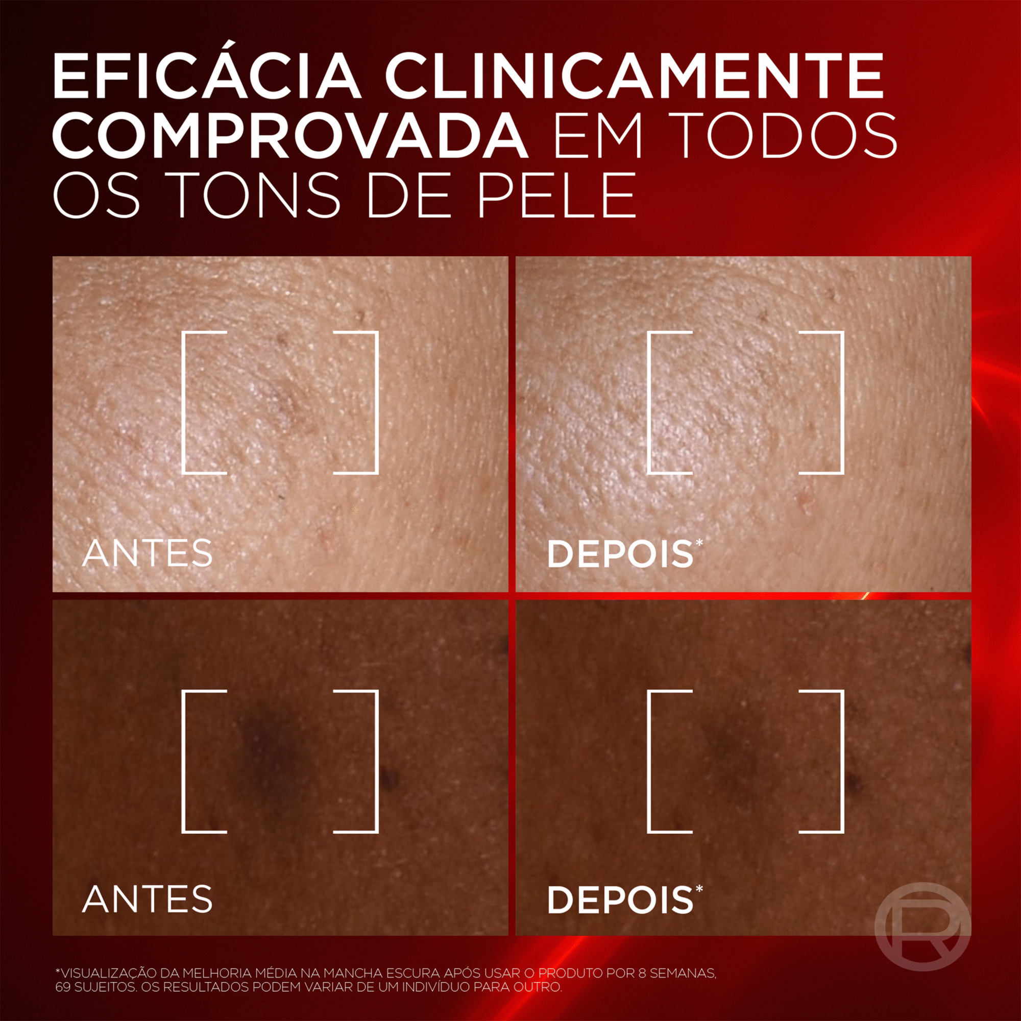 S&eacute;rum Facial Revitalift Laser Triple L'Or&eacute;al Paris