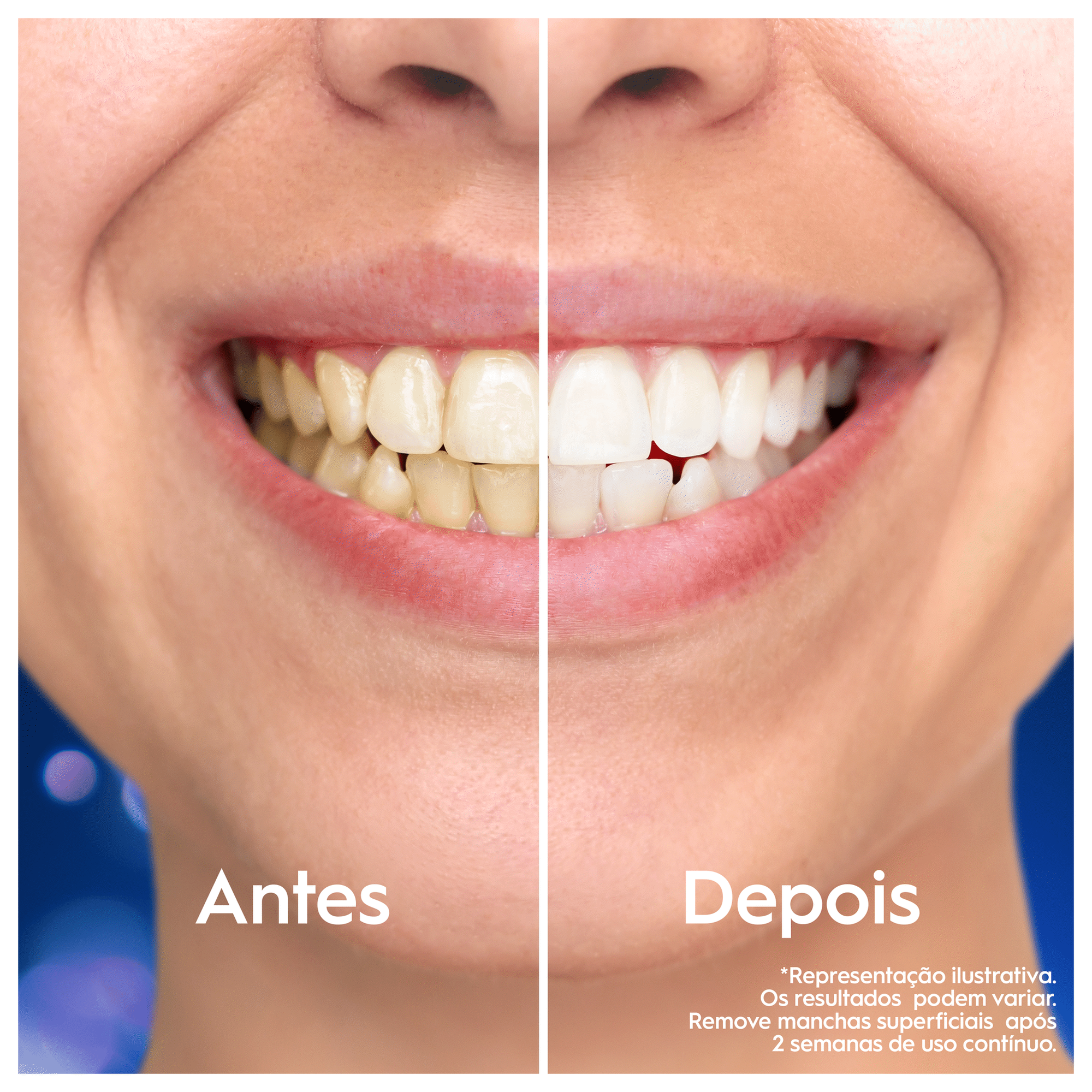 Coffret Escova de Dentes El&eacute;trica iO2 Oral-B