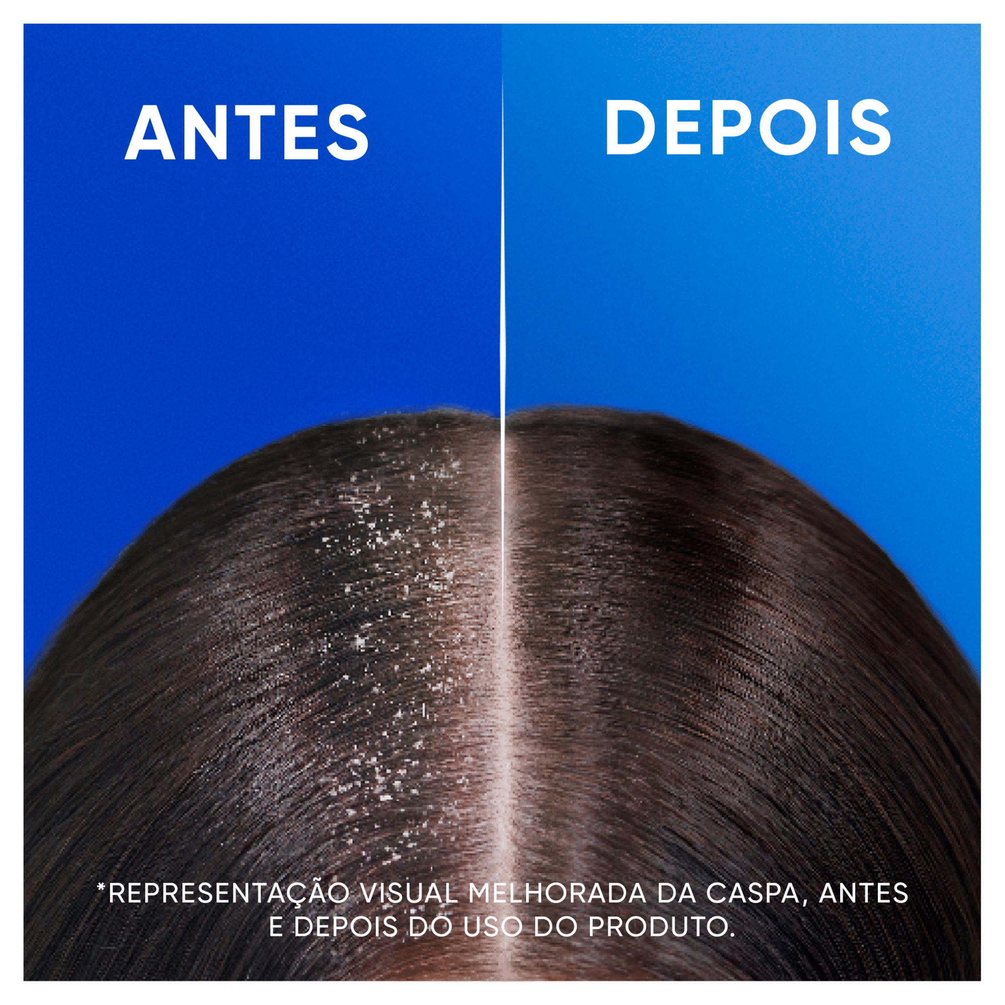 Champ&ocirc; Anticaspa Mentol H&S