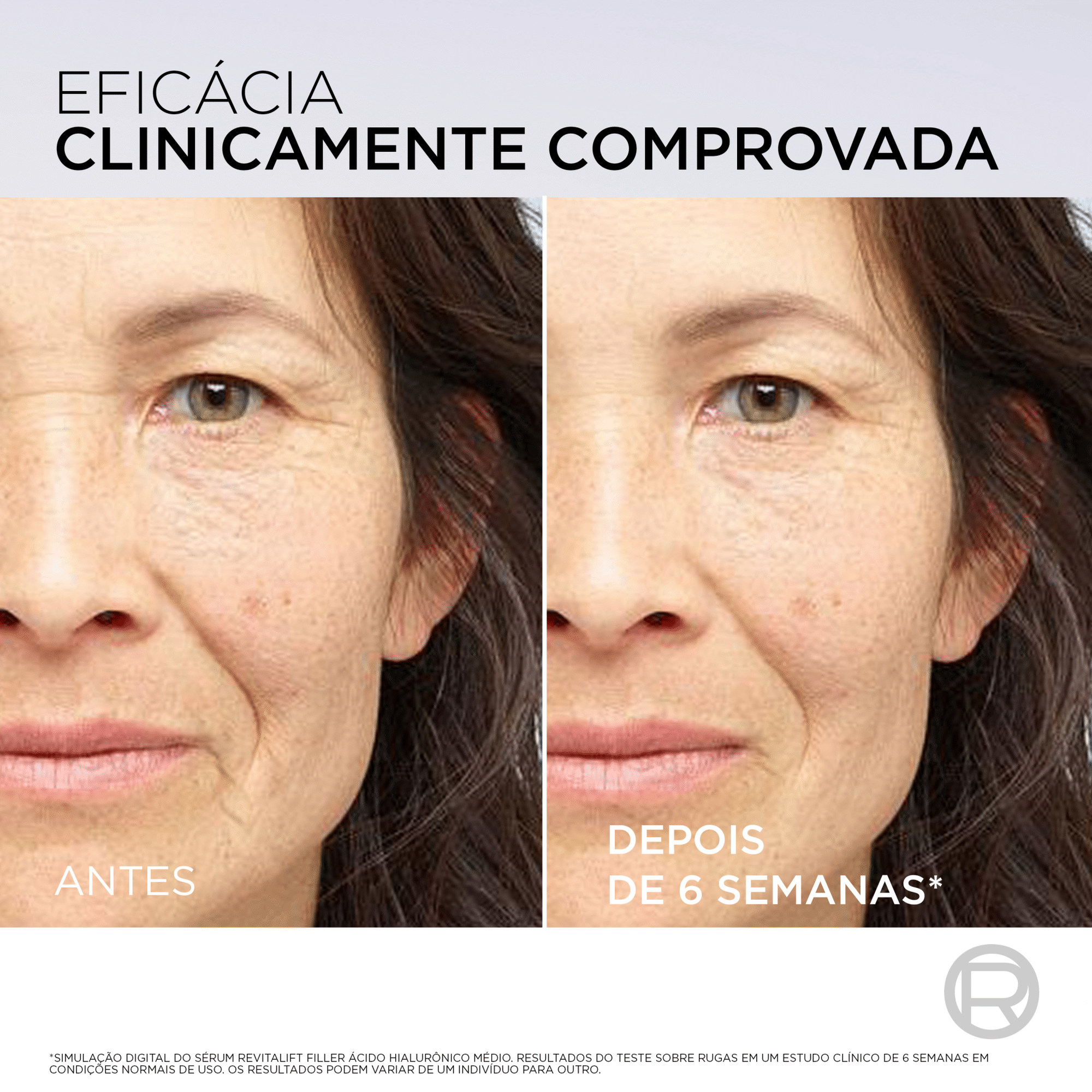 S&eacute;rum Facial Revitalift Filler Antirrugas L'Or&eacute;al Paris
