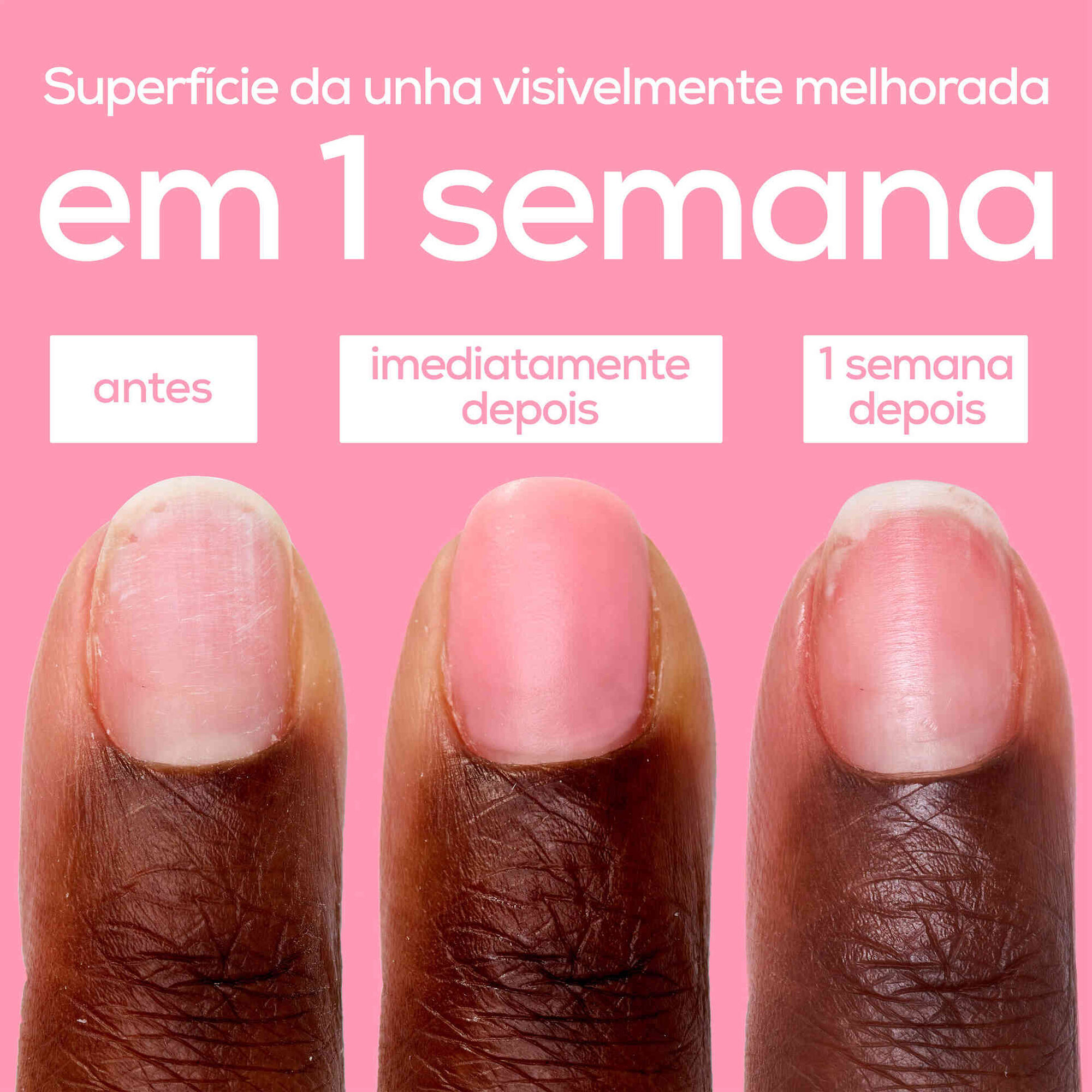 Aperfeiçoador de Unhas
