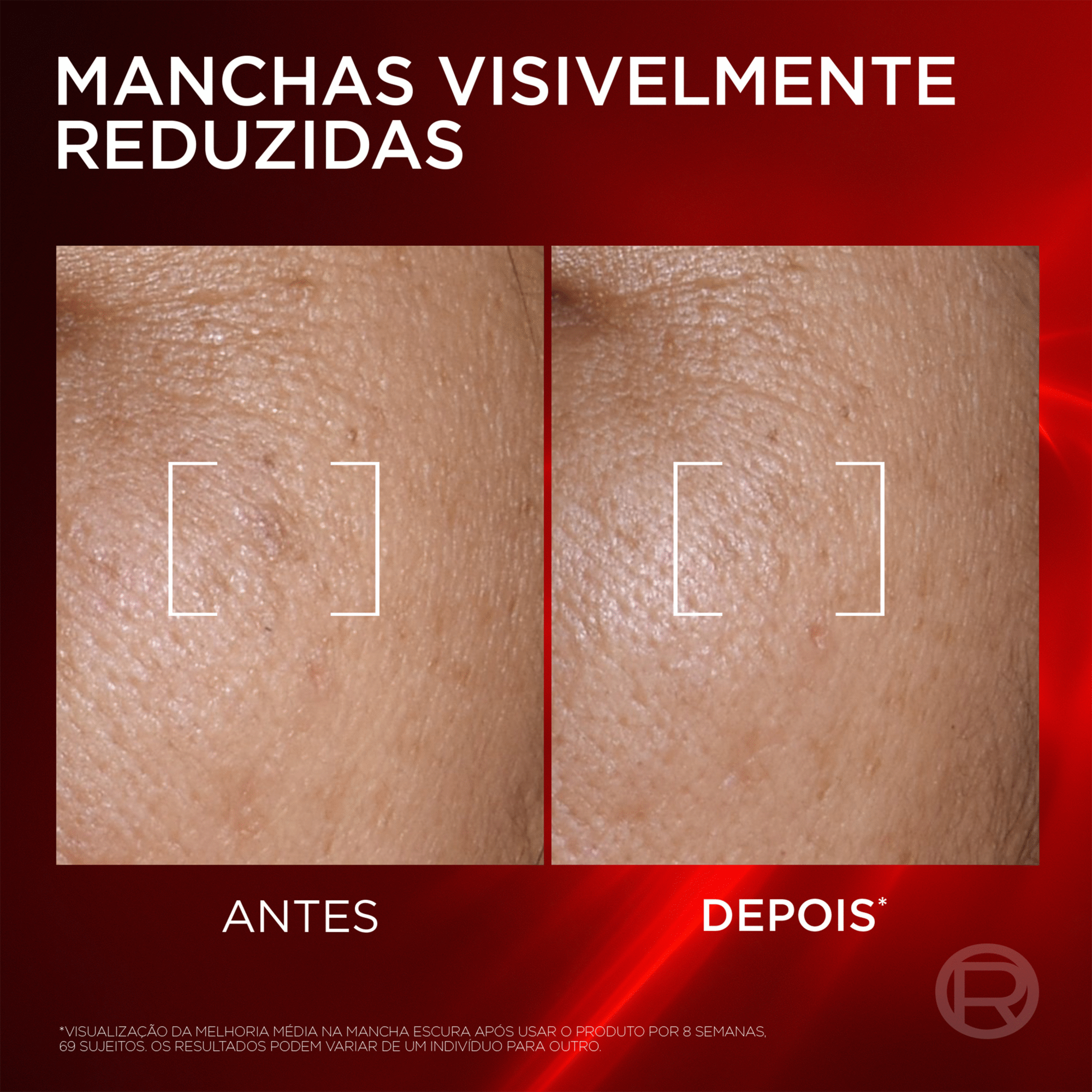 S&eacute;rum Facial Revitalift Laser Triple L'Or&eacute;al Paris