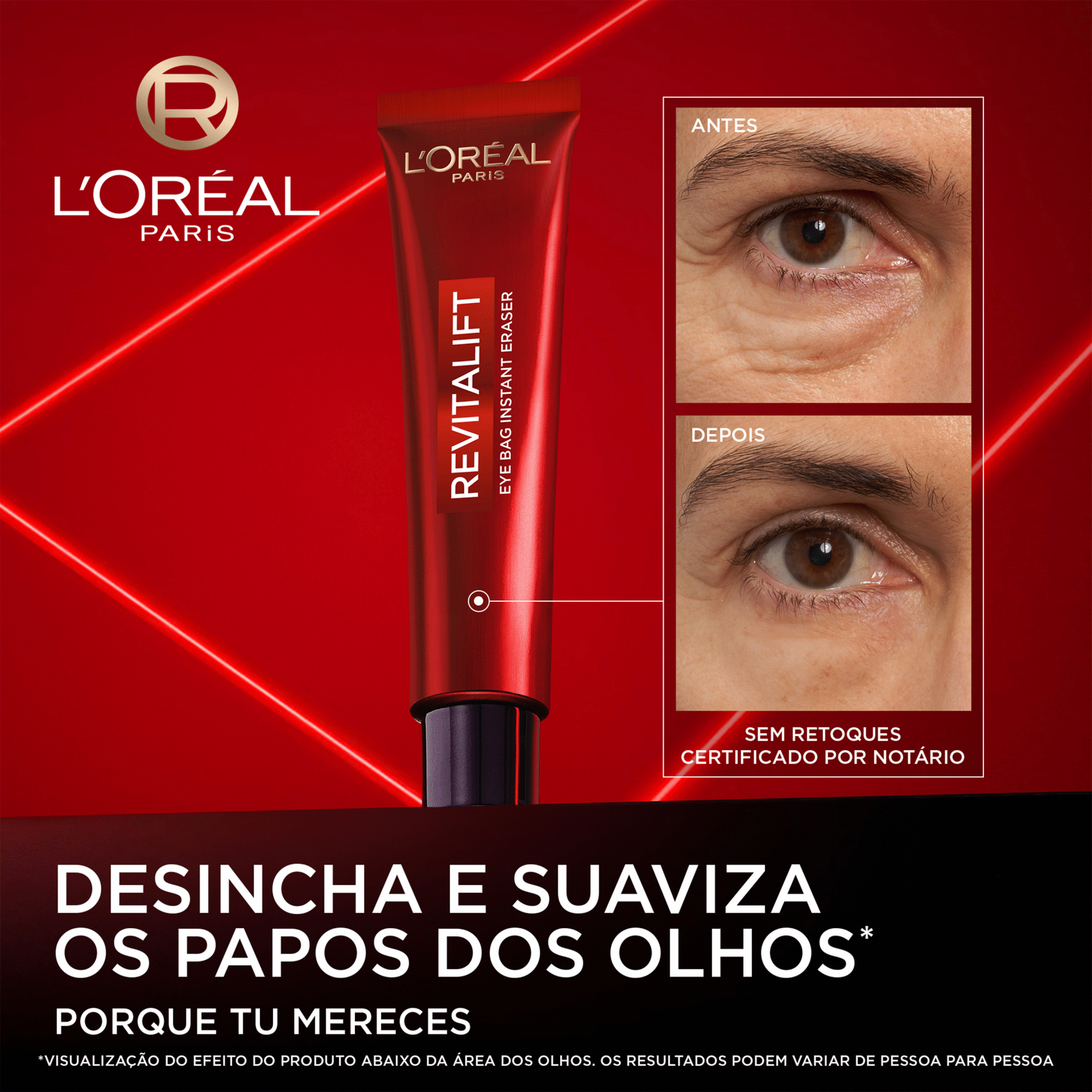Creme de Olhos Revitalift Laser L'Or&eacute;al Paris