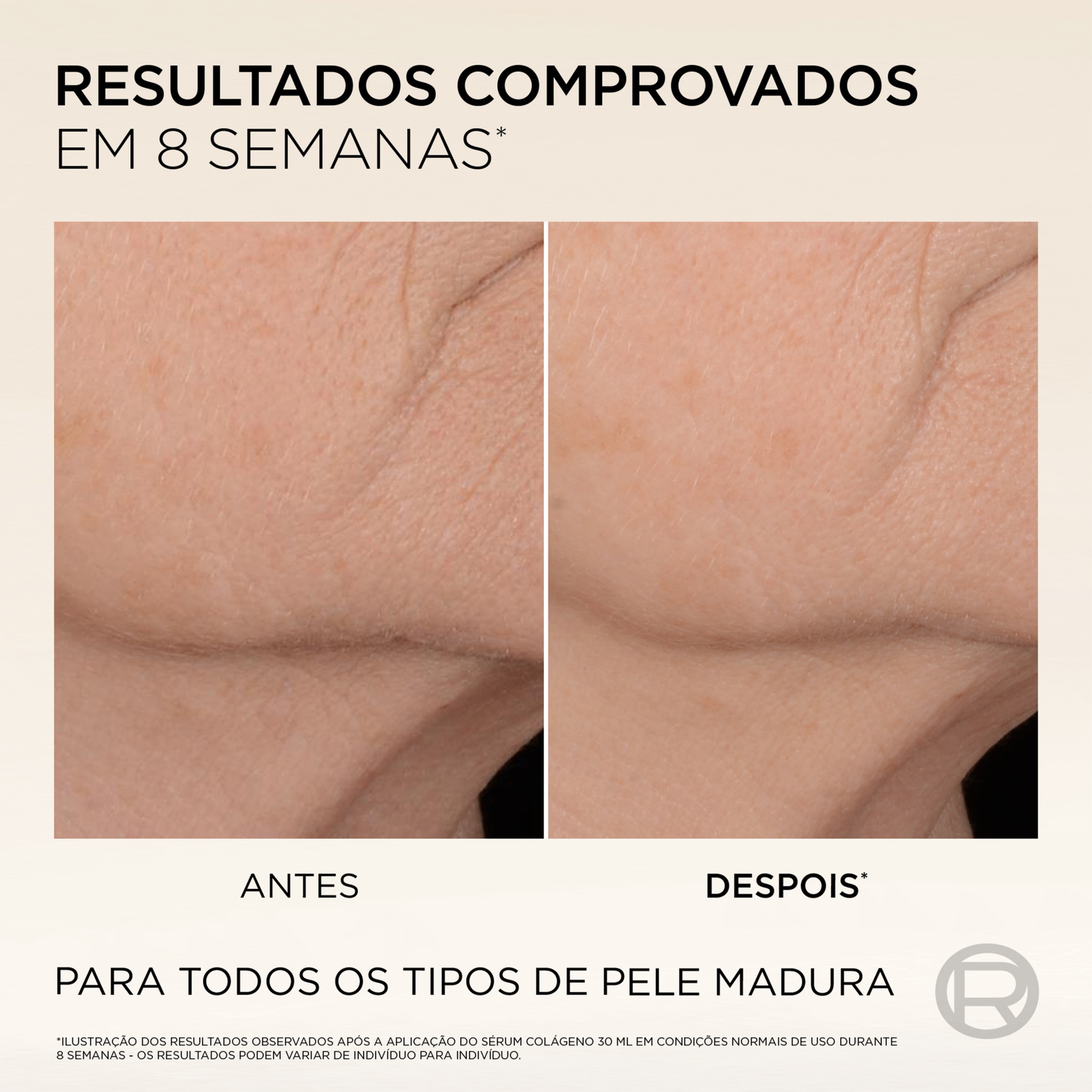 S&eacute;rum Facial Age Perfect Antiflacidez Micro-Col&aacute;geno L'Or&eacute;al Paris