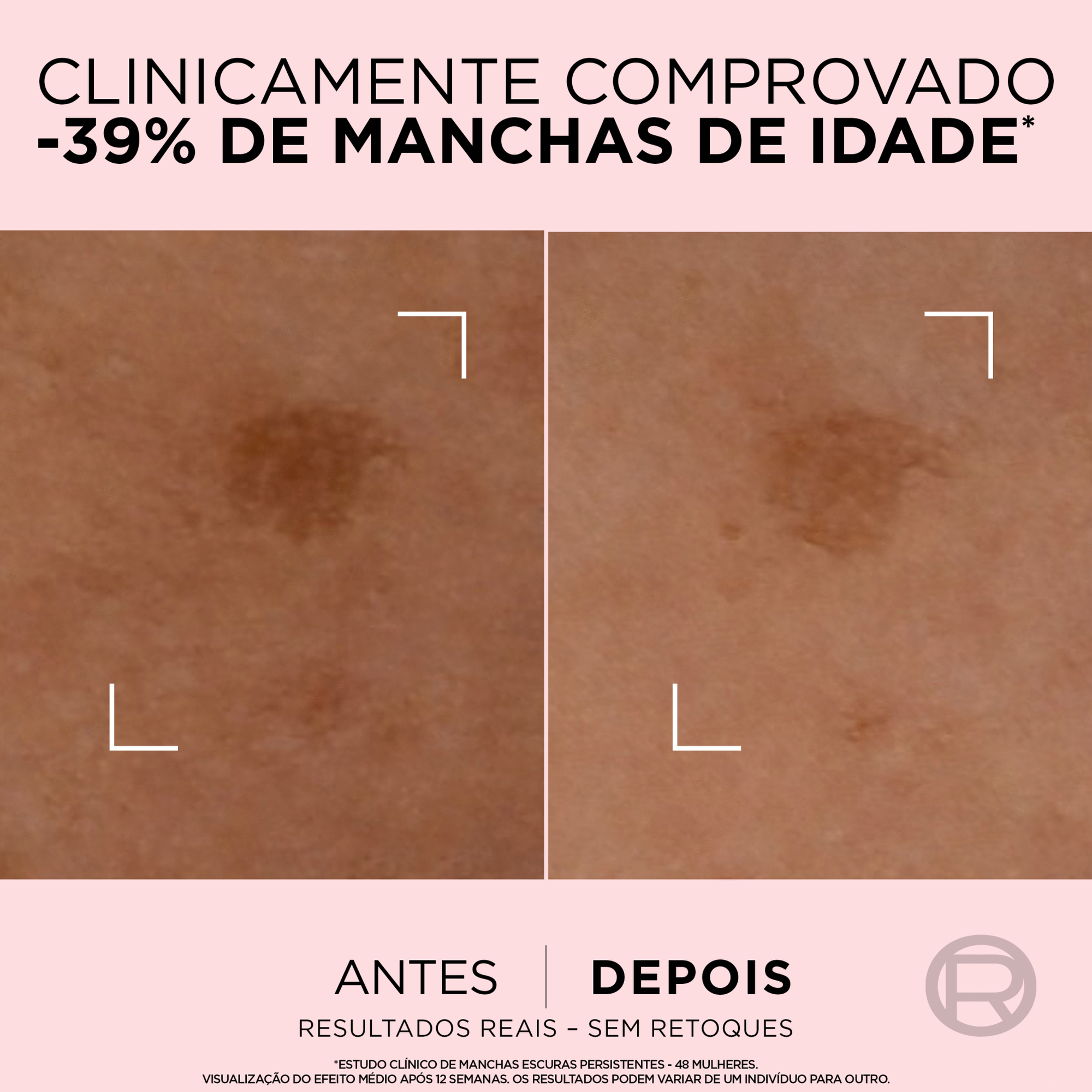 S&eacute;rum Facial Age Perfect Anti-manchas L'Or&eacute;al Paris