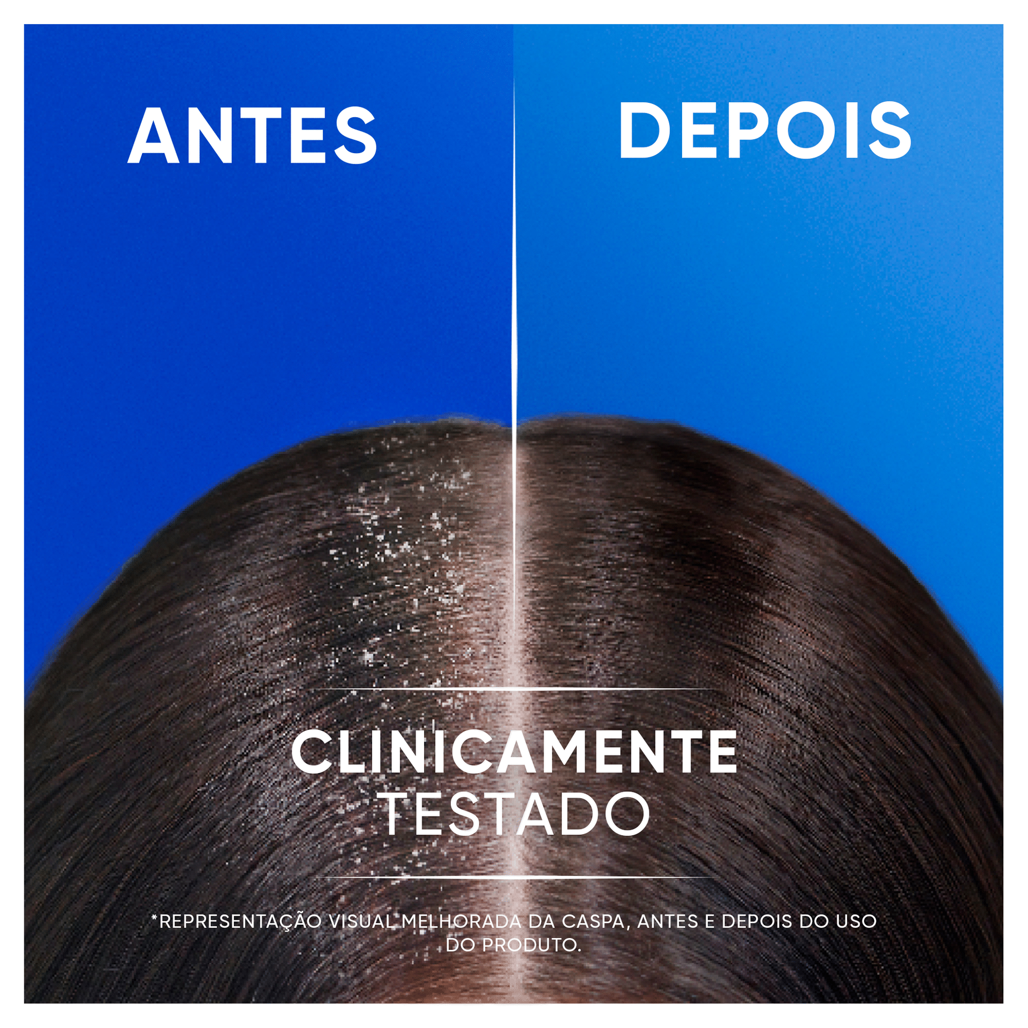 Champ&ocirc; Anticaspa Citrus 2 em 1 Plus H&S