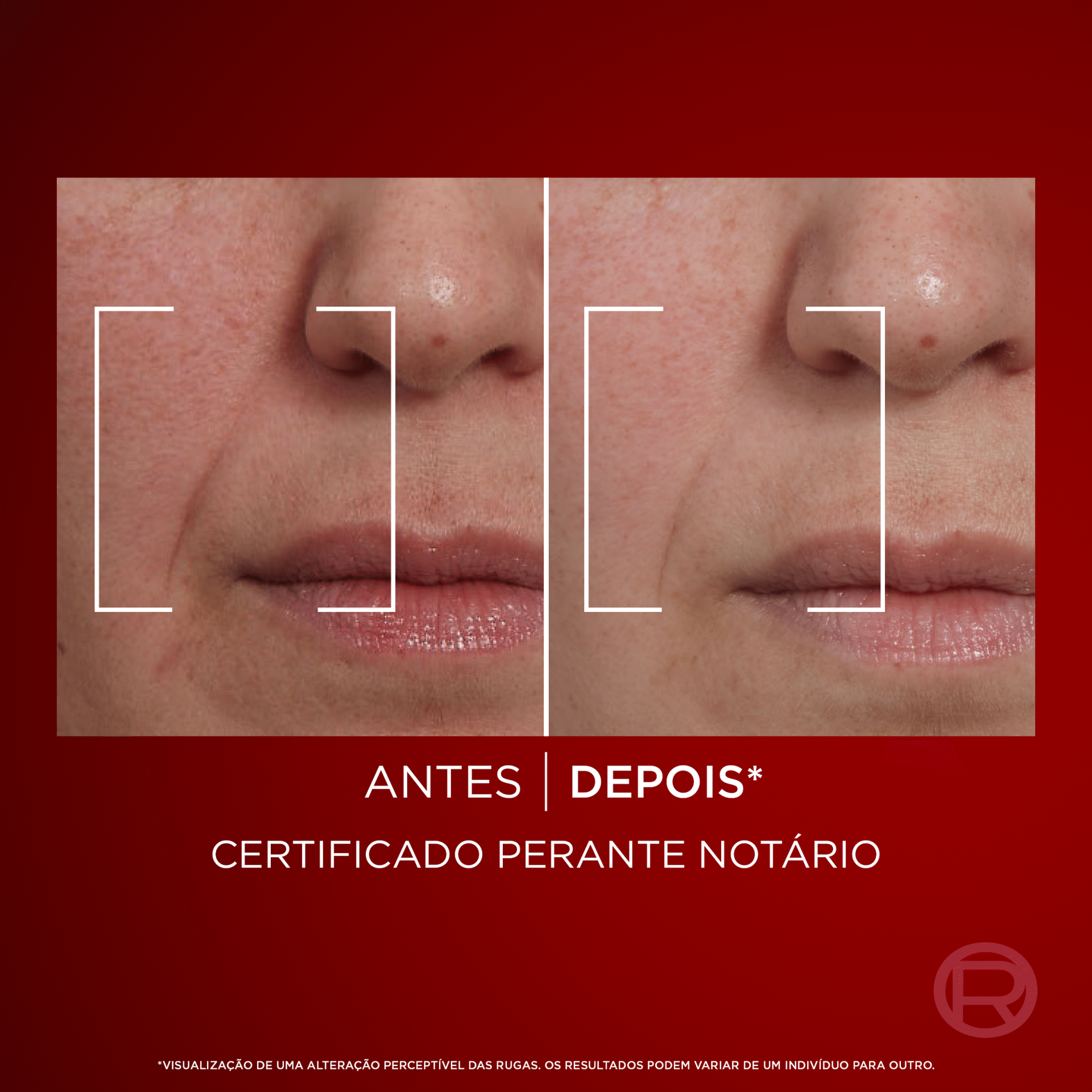 Creme de Rosto Dia Revitalift Laser Intensivo 40+ L'Or&eacute;al Paris